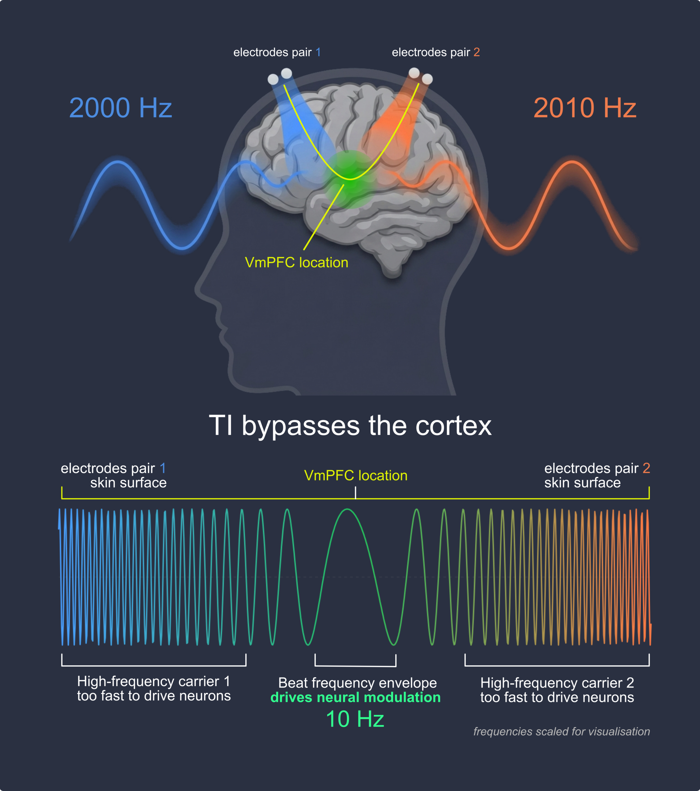 Temporal Interference waveform physics: 2000 Hz and 2010 Hz signals creating 10 Hz modulated envelope at deep brain target